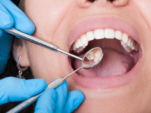 woman mouth open dentist looking inside
